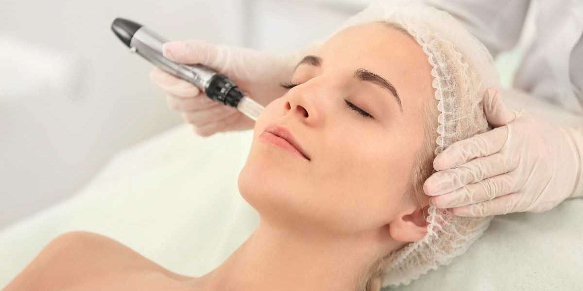 Microneedling Near Me | Beverly Hills Med Spa