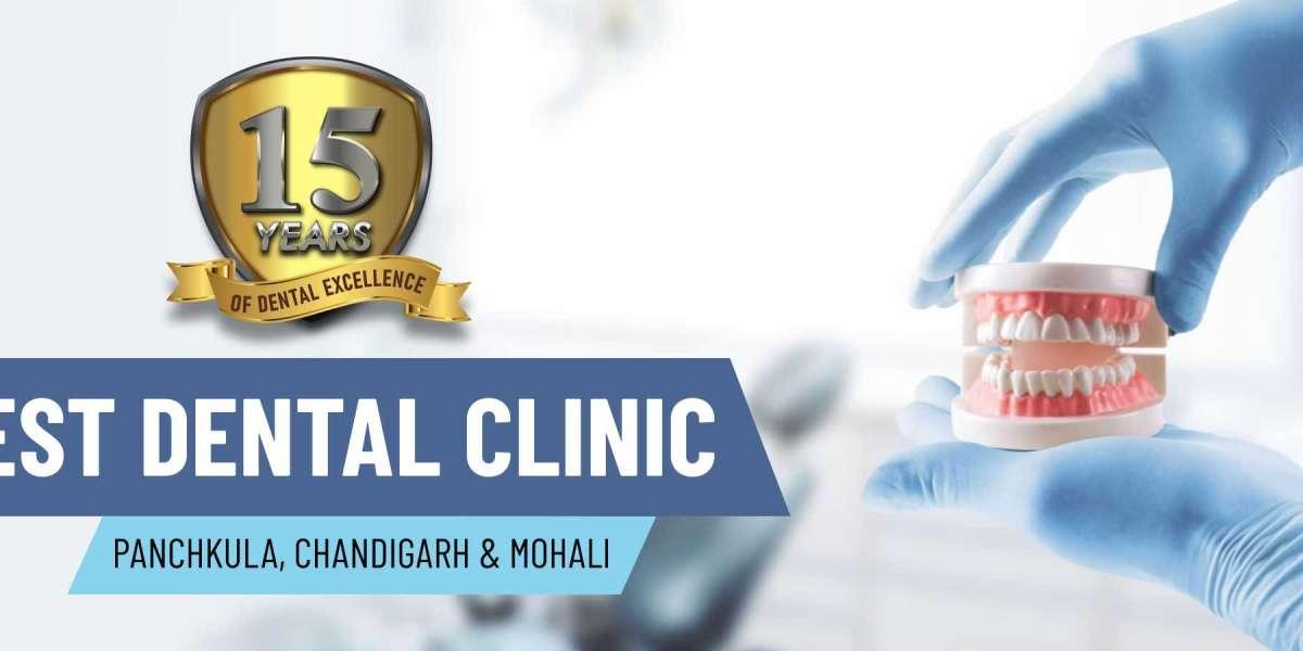 Best Dental Clinic in Chandigarh