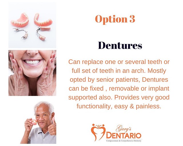 A Dentist in Gurgaon Offers Affordable Denture Care