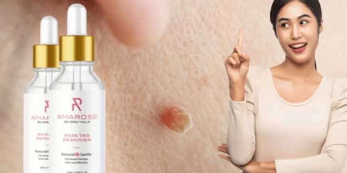 Amarose Skin Tag Remover: 100% Natural, Pure, Price, Work and Where To Buy