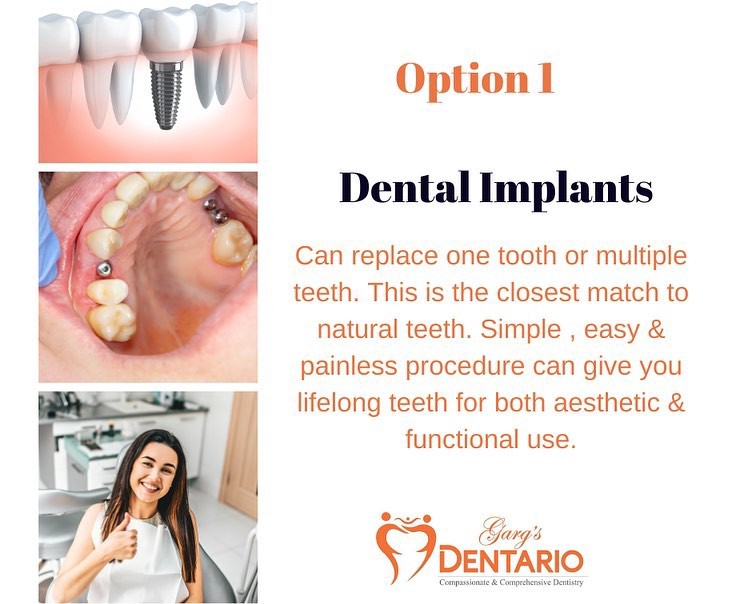 Dentists in Gurgaon Offer Extraordinary Service