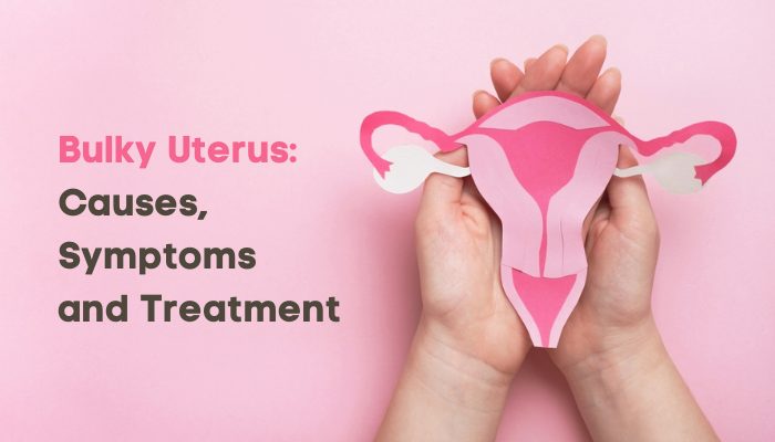 CAUSES OF BULKY UTERUS - Treatment Methods Bulky Uterus