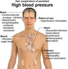 Get the Best Homeopathic Medicine for Hypertension at Best Cost