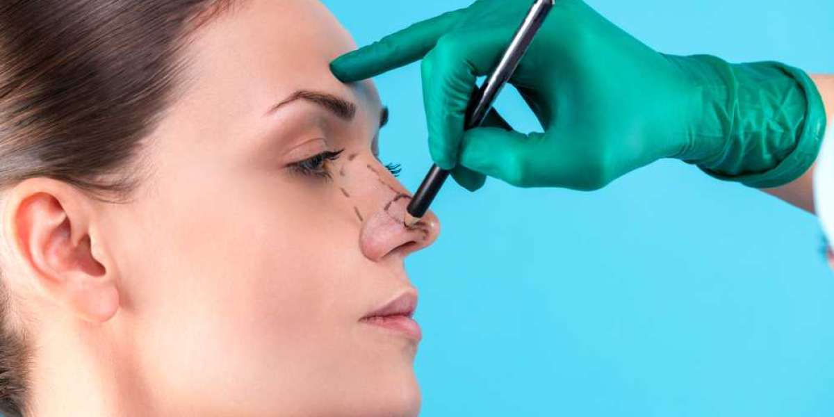 The History of Rhinoplasty - From Ancient Times to Modern Techniques