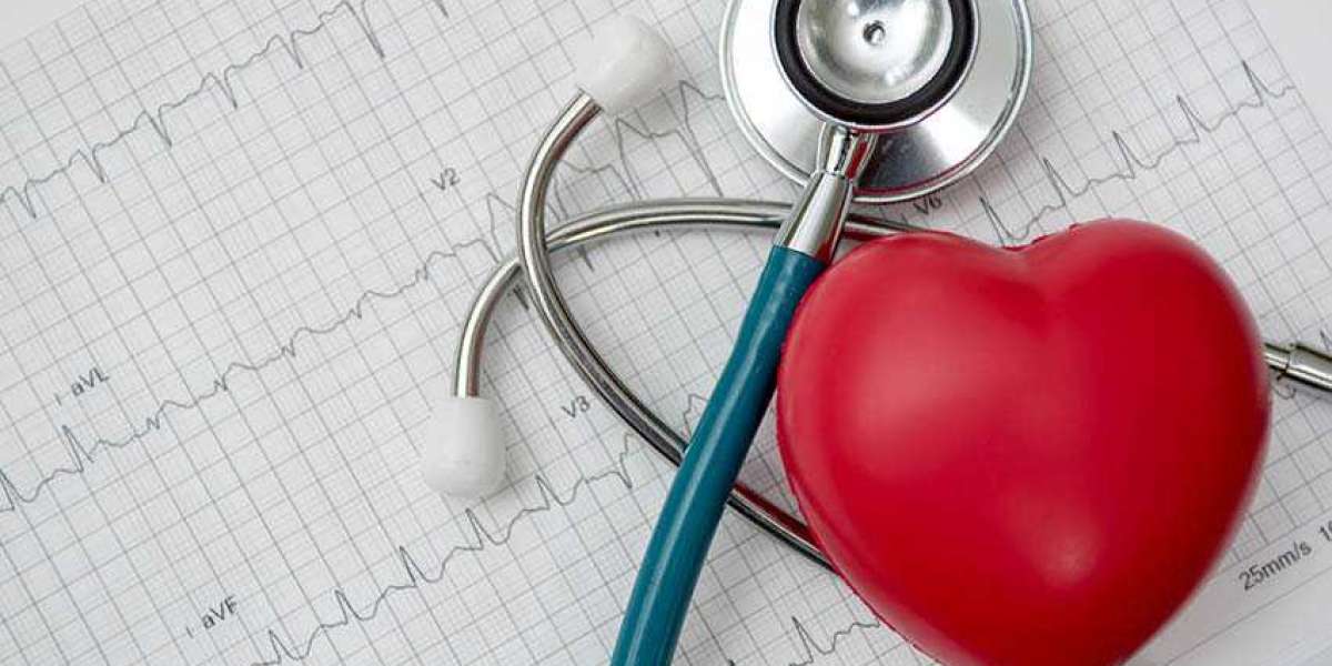 What are Heart checkup packages?