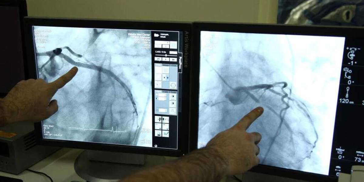 Coronary Angiography Devices Market Trends Report on Latest & Forthcoming Scenerio