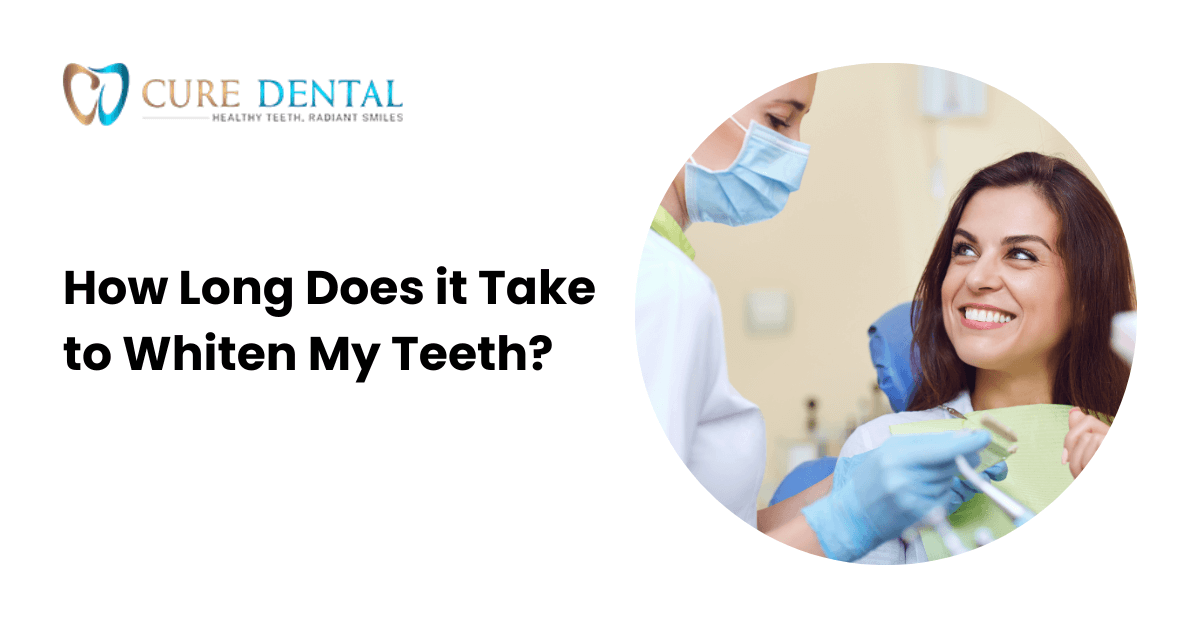 How Long Does it Take to Whiten My Teeth? - Cure Dental
