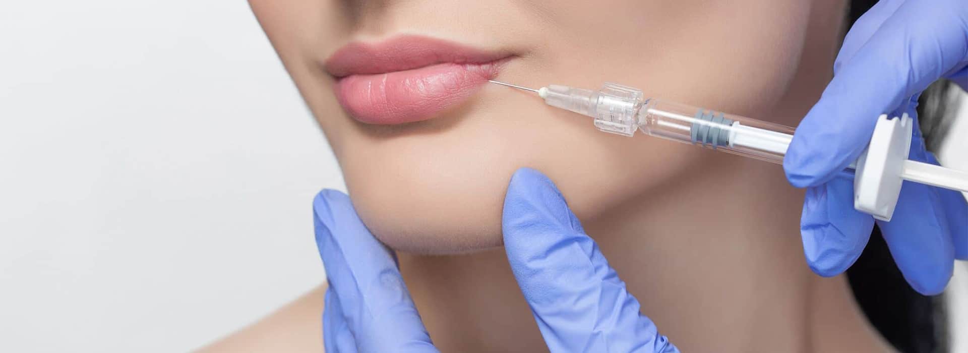 Fillers in Dubai | Lip Augmentation Dubai | Dermal Fillers Dubai | Lip Injection Jumeirah | Lip Fillers Clinic Jumeirah