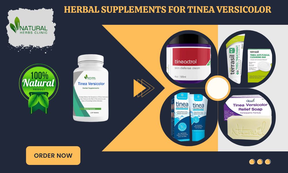 Best 8 Effective Tinea Versicolor Herbal Remedies Reviews