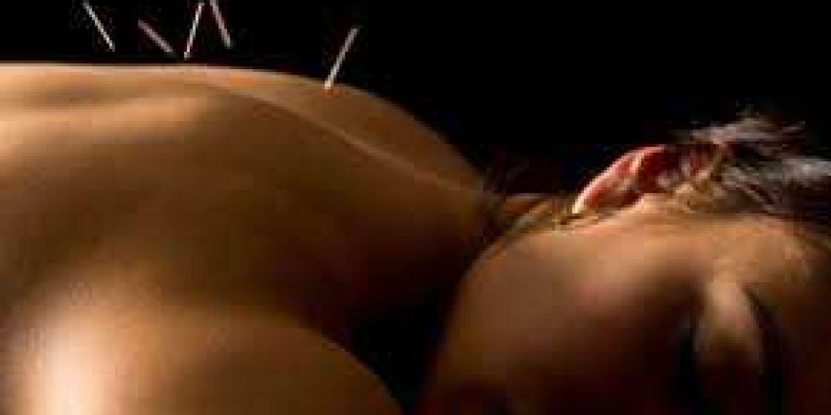 Getting Acupuncture for Neck Pain in Morristown: Natural Relief