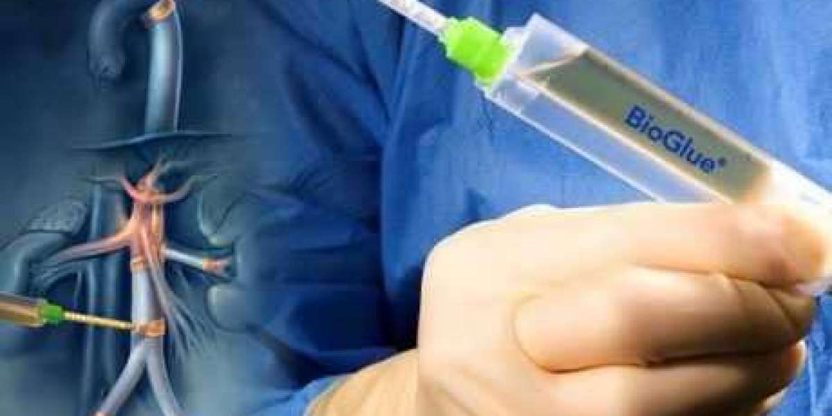 Surgical Glues Market Size, Share, Trends, Industry Overview & Future Forecast 2030