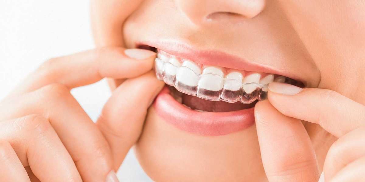 How to Choose the Right Orthodontist for Invisalign Treatment?