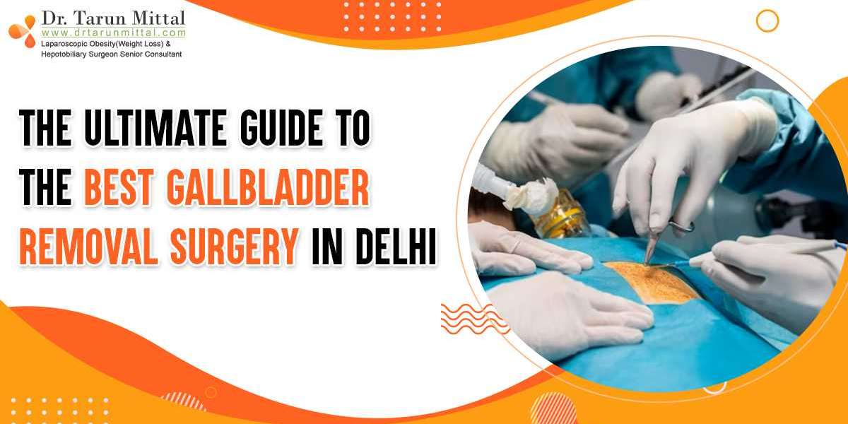 The Ultimate Guide to the Best Gallbladder Removal Surgery in Delhi