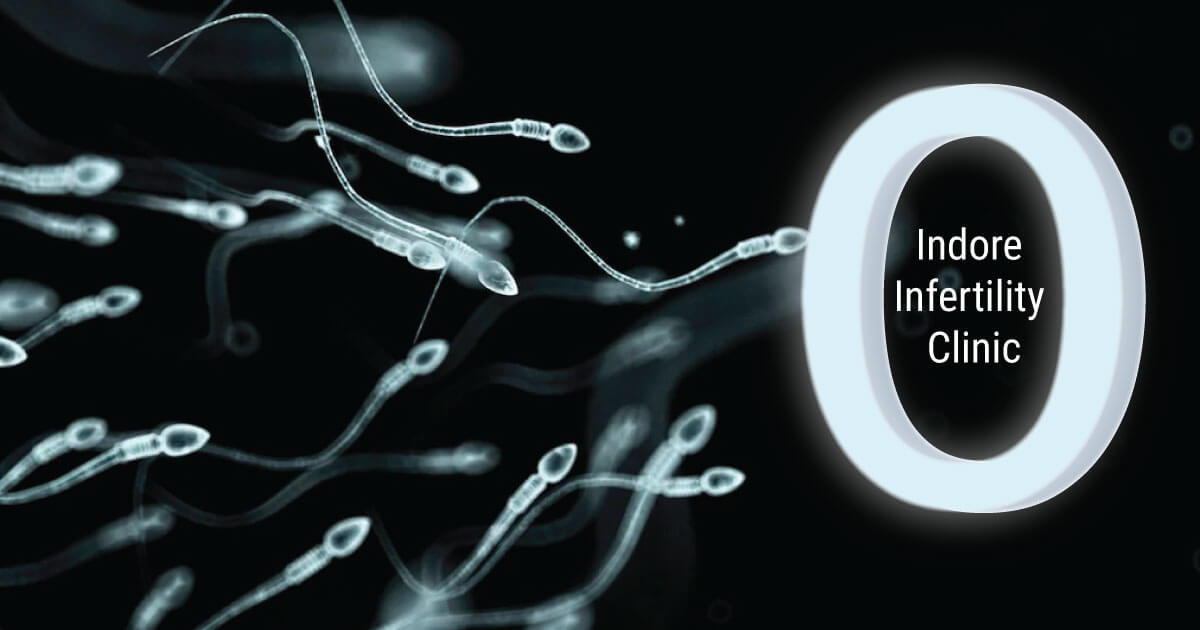 Azoospermia - Or Nil / No Sperm Treatment by Best IVF Doctor