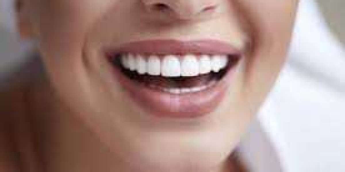 Dental Implants: A Lifeline for Your Smile