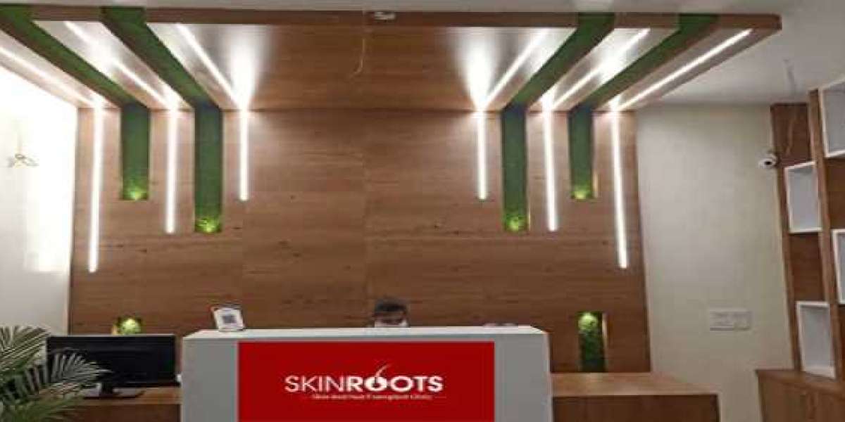 Transform Your Look with Hair Transplant in Delhi - Skinroots Clinic