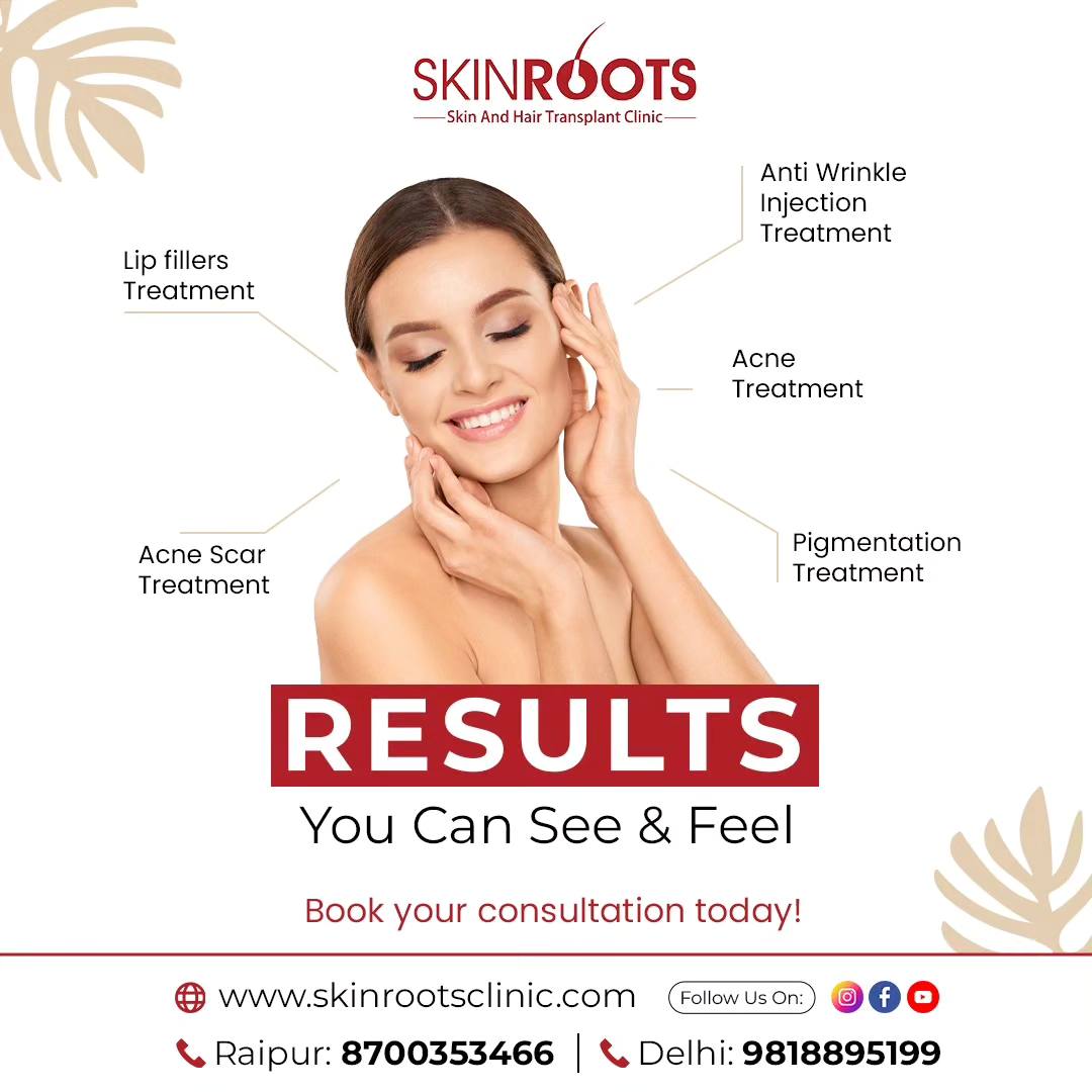 What to Expect From the Best Dermatologist in Delhi? – Skinroots Clinic
