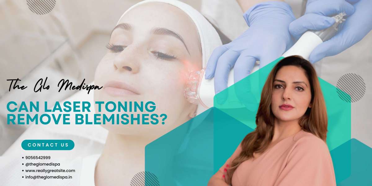 Can Laser Toning Remove Blemishes?