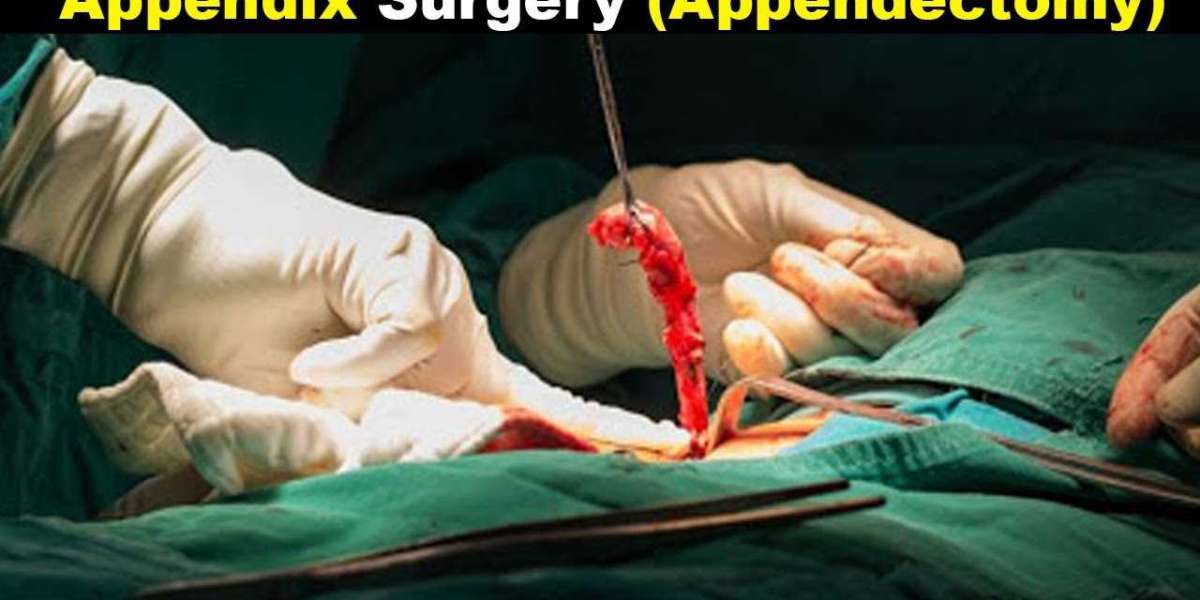 Best Laparoscopic Surgery in Delhi Dr. Tarun Mittal