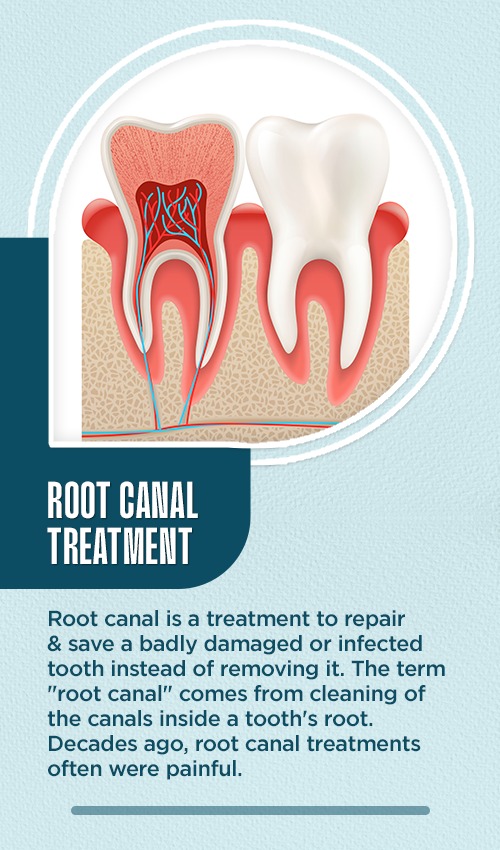Root canal treatment in Gurgaon | Best root canal treatment in Gurgaon | Rct Cost In Gurgaon | Best Dentist In Gurgaon - DR Dabas