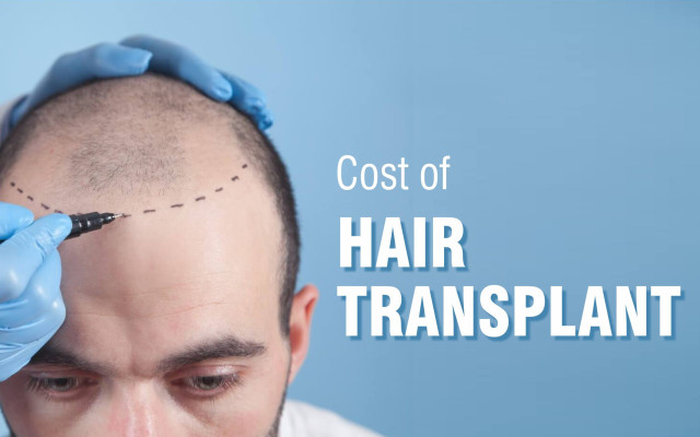 Harleys Hair Transplant on Tumblr: Why Mumbai Is A Hub For Hair Transplantation?