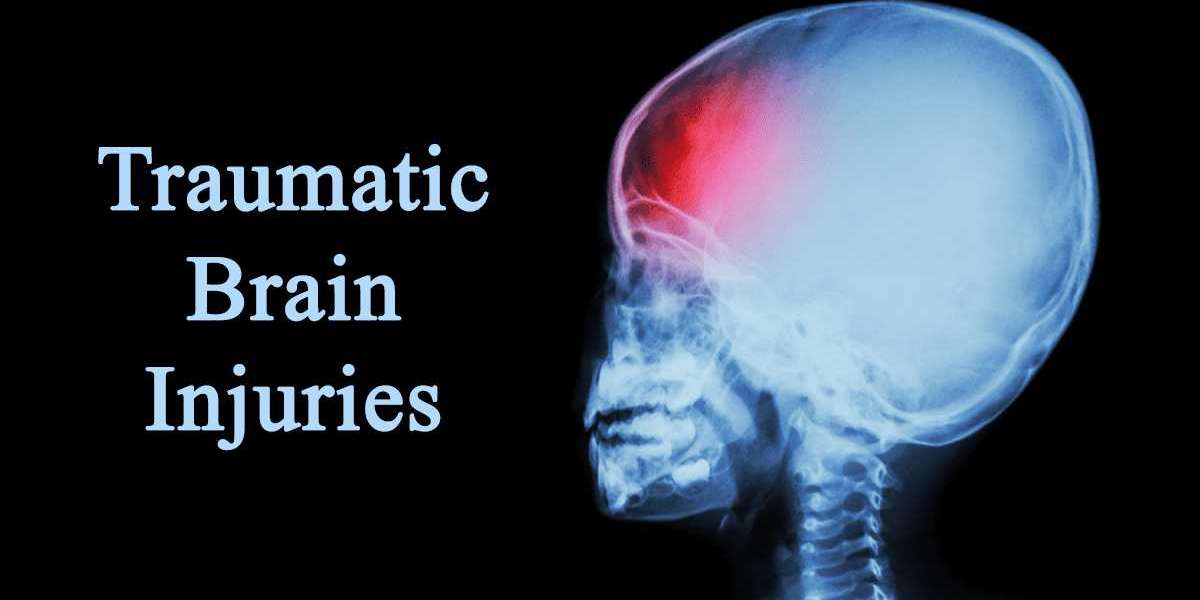 Understanding the Distinctions and Open vs. Closed Traumatic Brain Injury