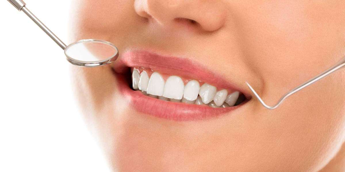 Tooth Care Restoration: A Detailed Examination in a Guest Post