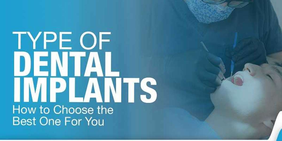 A Revolutionary Approach to Dental Implants in Gurgaon